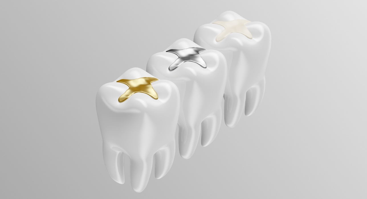 Tooth-Colored Fillings in Middletown, OH at MK&C Dental