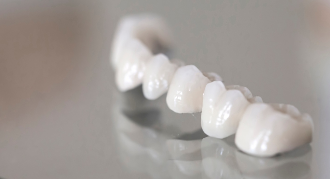 Porcelain Crowns Middletown, OH