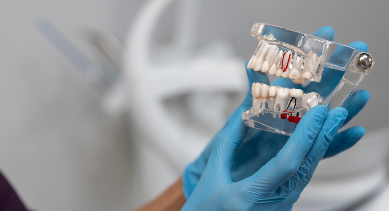 Root Canal Treatment at MK&C Dental in Middletown