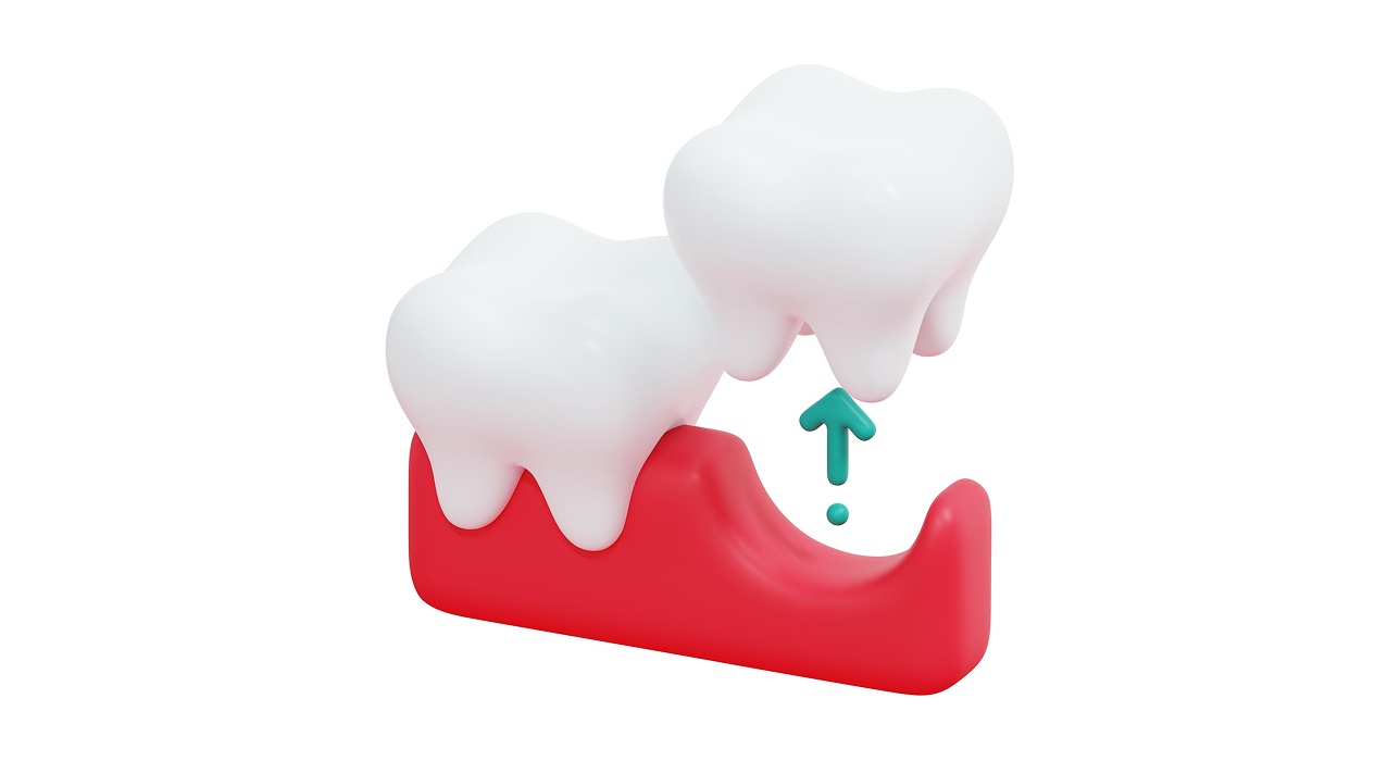 Tooth Extraction Consultation in Middletown